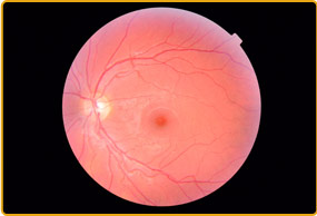 Retina Eye Test